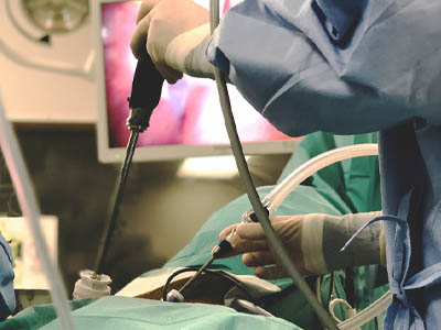 Keyhole surgery using an endoscopic insufflator